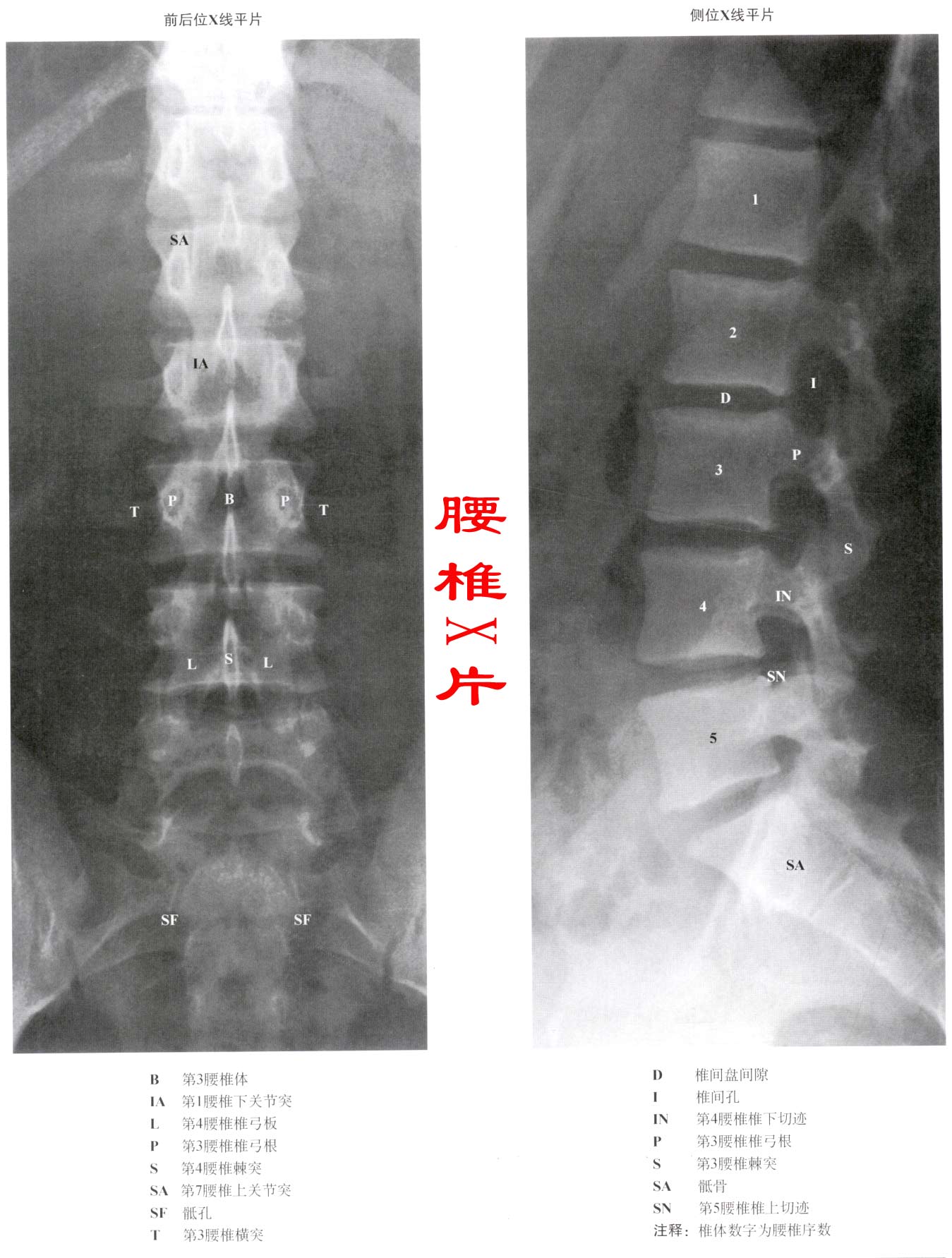 正常人的腰椎x线图片图片