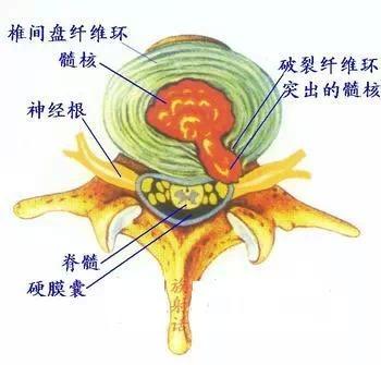 颈椎及颈椎病分类颈椎病病因颈椎病症状颈椎病诊断依据颈椎病治疗颈椎